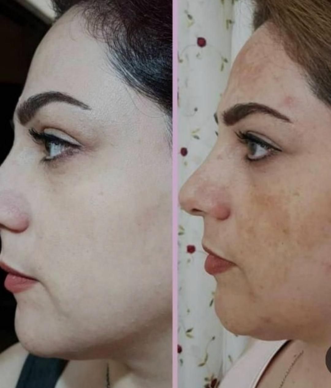 کرم سفید کننده،ضد لک،ضد جوش صورت و دست و پا|آرایشی، بهداشتی، درمانی|درگهان, |دیوار