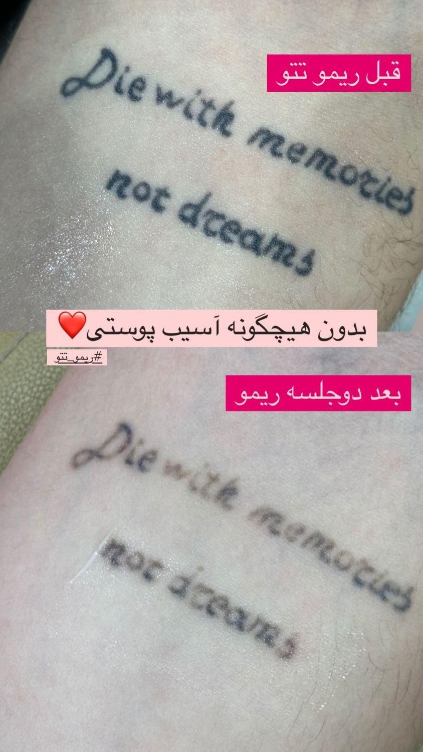 کربن هالیوودی و ریمو تتومشکی و رنگی|خدمات آرایشگری و زیبایی|ارومیه, |دیوار