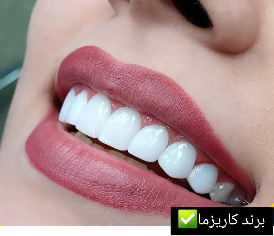کامپوزیت دندان، روکش، دندانپزشکی تخصصی صدف تهرانسر|خدمات آرایشگری و زیبایی|تهران, تهرانسر مرکزی|دیوار