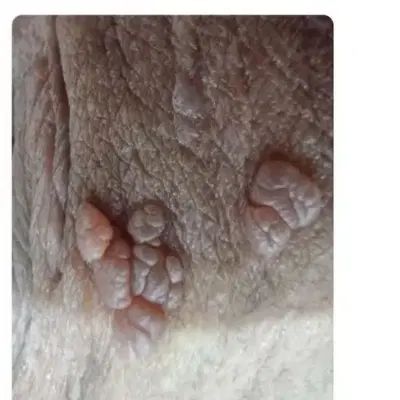 حذف 3روزه|آرایشی، بهداشتی، درمانی|رشت, حومه رشت|دیوار