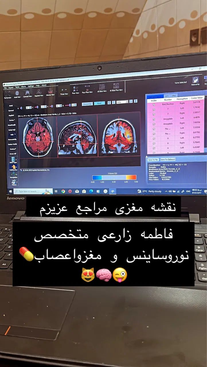 آموزش نوروفیدبک نقشه مغزی|خدمات آموزشی|اصفهان, شمس آباد|دیوار
