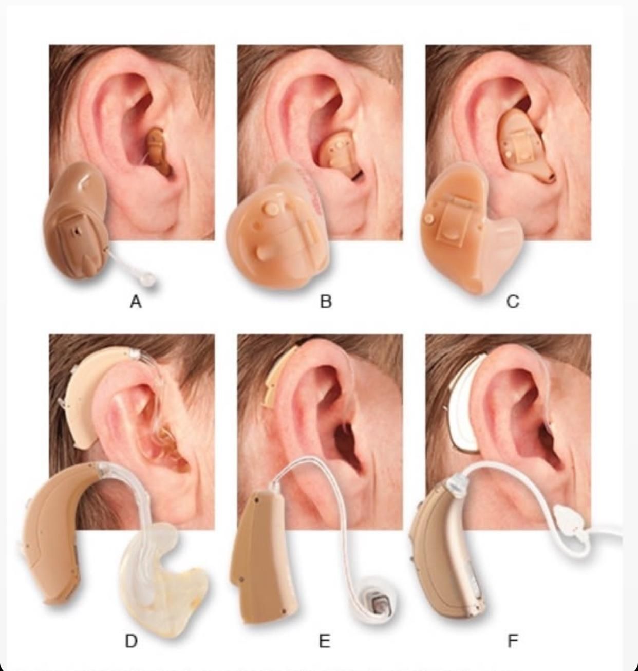 سمعک و شنوایی سنجی پردیس|آرایشی، بهداشتی، درمانی|پردیس, فاز ۲|دیوار