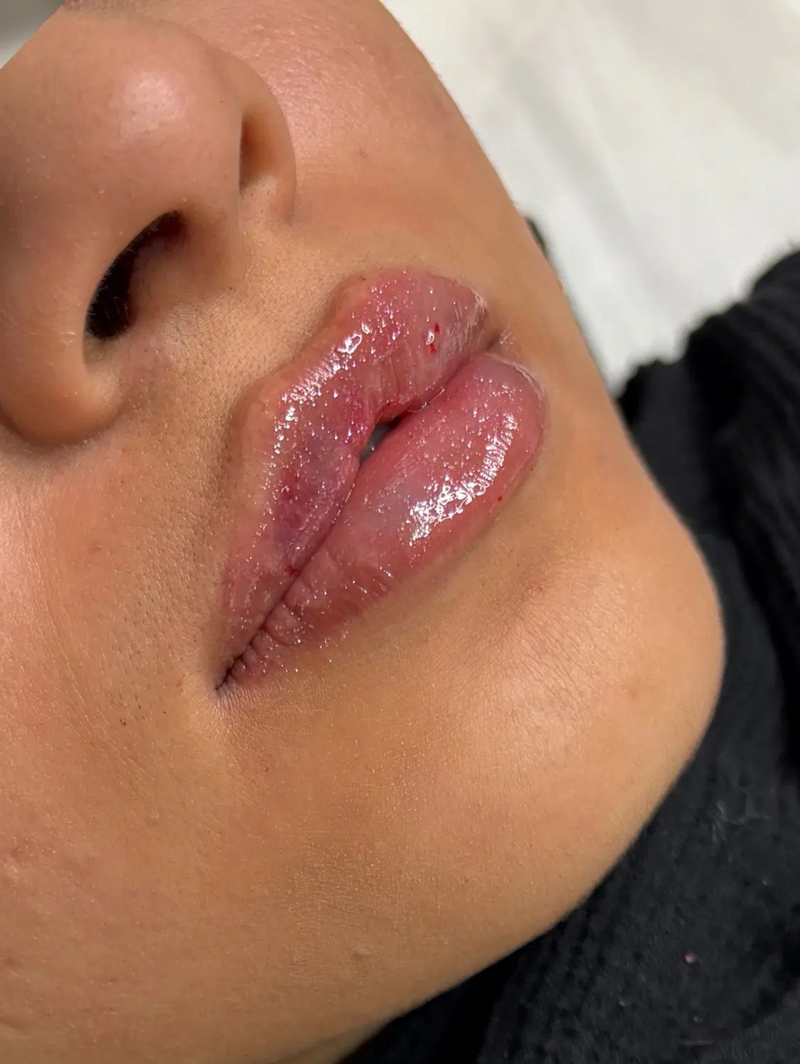 تزریق تخصصی ژل و بوتاکس  مشاوره رایگان|خدمات آرایشگری و زیبایی|اصفهان, خلیل آباد|دیوار