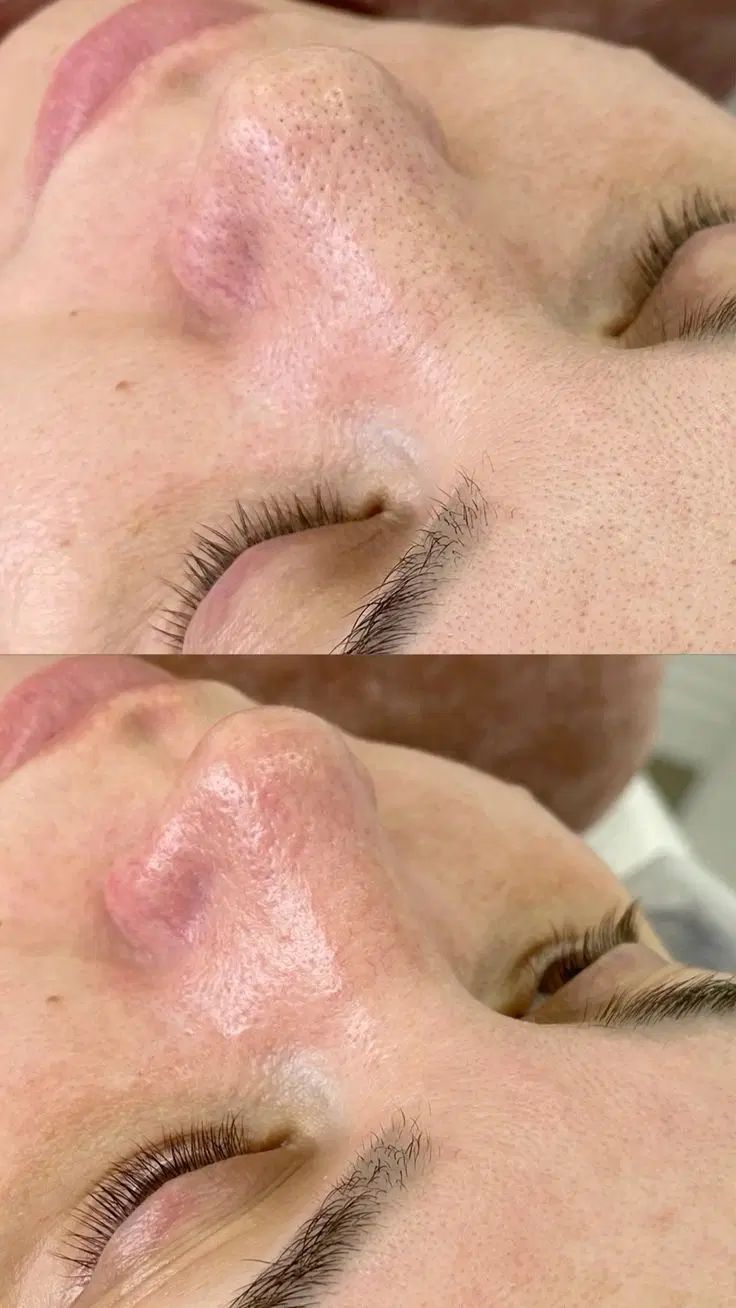 فیشیال تخصصی،پاکسازی پوست حرفه ای،جوانسازی صورت|خدمات آرایشگری و زیبایی|تهران, دانشگاه شریف|دیوار