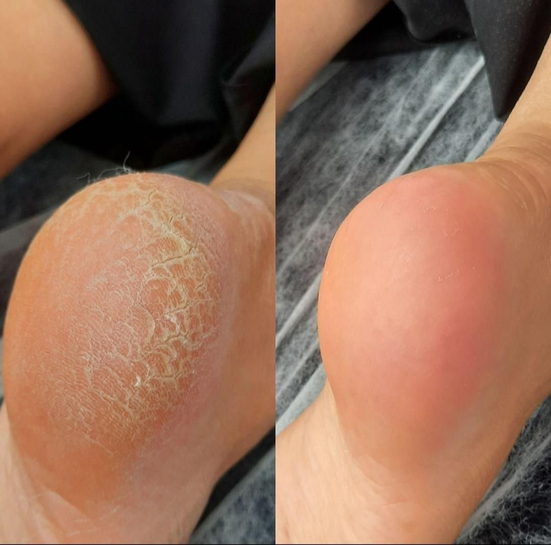 پدیکور درمانی|خدمات آرایشگری و زیبایی|اسدآباد, |دیوار