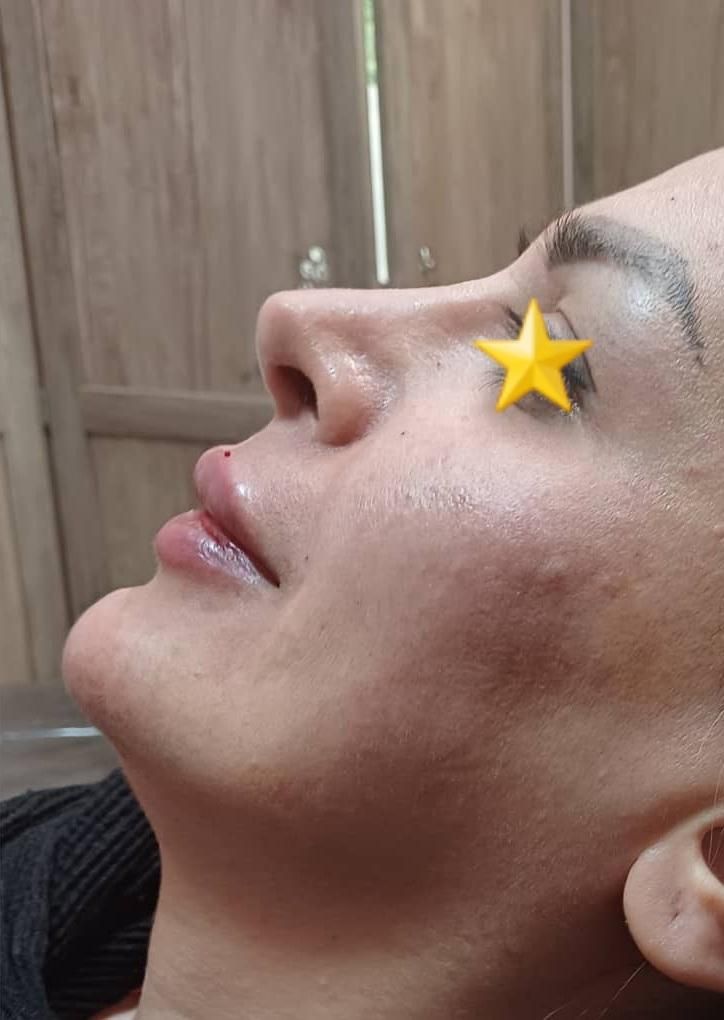 بوتاکس و ژل و لیزر|خدمات آرایشگری و زیبایی|تهران, امیریه|دیوار