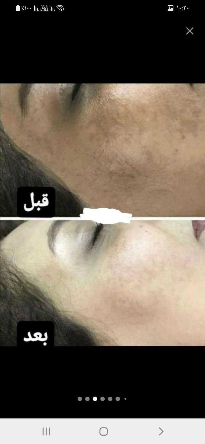 کرم معجزه صابون صندل ۱۲۵گرمی|آرایشی، بهداشتی، درمانی|ورامین, ورامین|دیوار