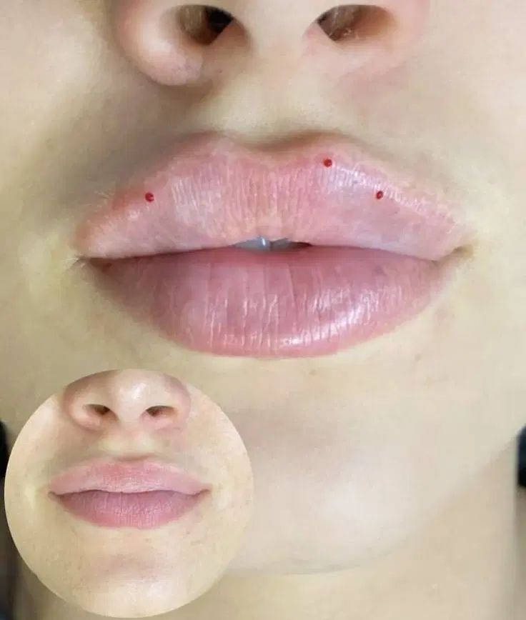 ژل،بوتاکس،مزوتراپی مو صورت،آنزیم،فیلرلب|خدمات آرایشگری و زیبایی|کرج, ساماندهی|دیوار