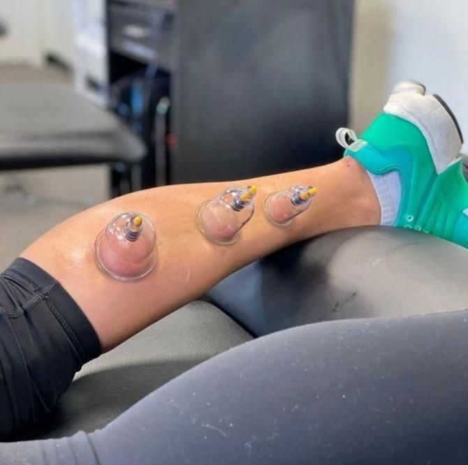 حجامت بادکش امبدینگ طب سوزنی زگیل تناسلی hpv|خدمات آرایشگری و زیبایی|اصفهان, جاوان|دیوار