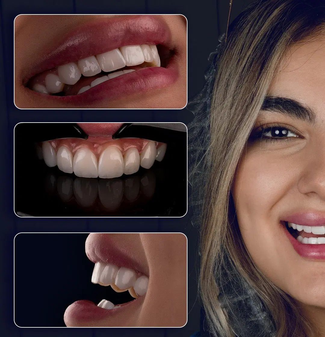 دندانپزشکی/کامپوزیت/لمینت/ایمپلنت|خدمات آرایشگری و زیبایی|مشهد, هفت تیر (حافظ)|دیوار