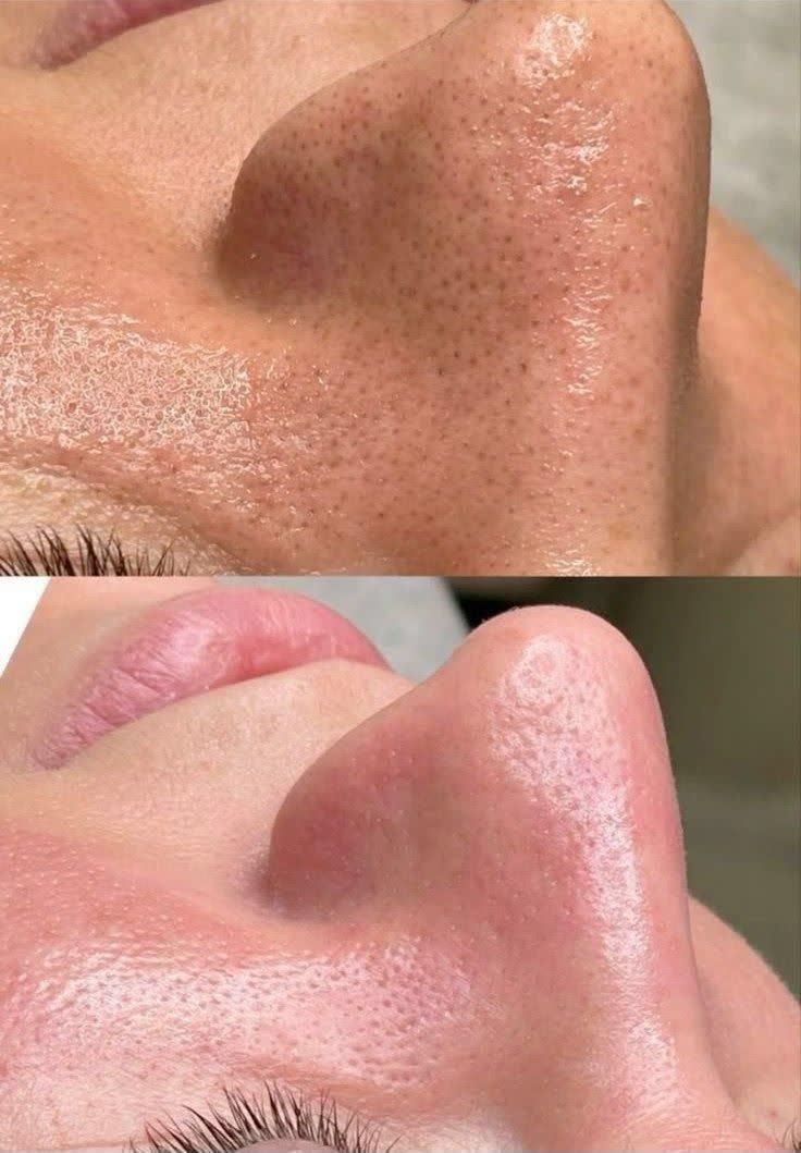 پاکسازی و فشیال صورت ویژه  بانوان و آقایان|خدمات آرایشگری و زیبایی|اردکان, |دیوار
