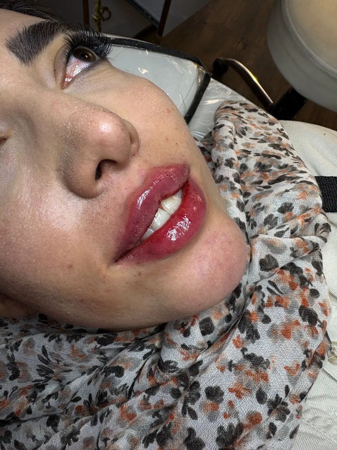 تزریق تخصصی ژل و بوتاکس  مشاوره رایگان|خدمات آرایشگری و زیبایی|اصفهان, خلیل آباد|دیوار