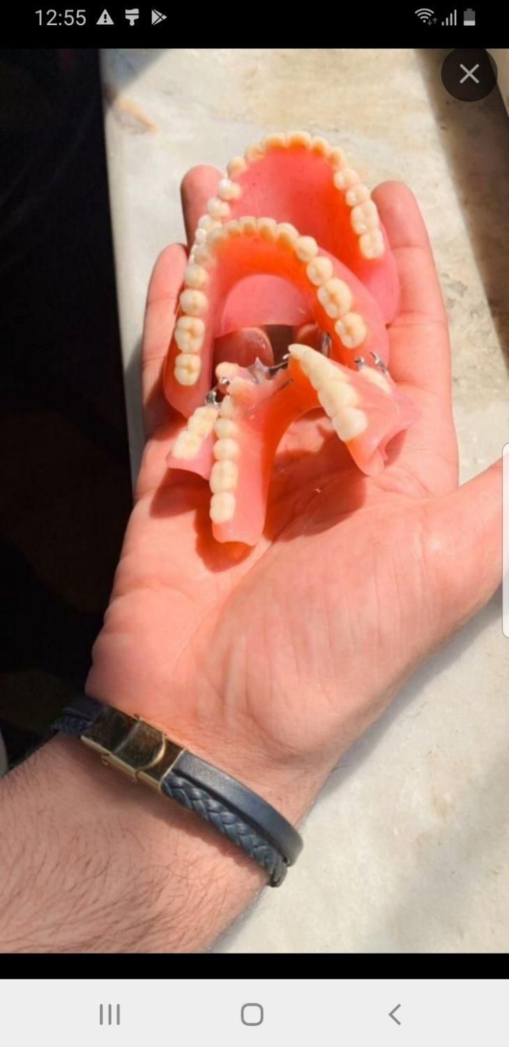 دندانسازی با نازل ترین قیمت|خدمات آرایشگری و زیبایی|قائمشهر, |دیوار