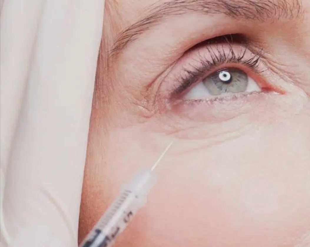 تخفیف خدمات زیبایی بوتاکس، فیلر،مزوتراپی|خدمات آرایشگری و زیبایی|اصفهان, اطشاران|دیوار