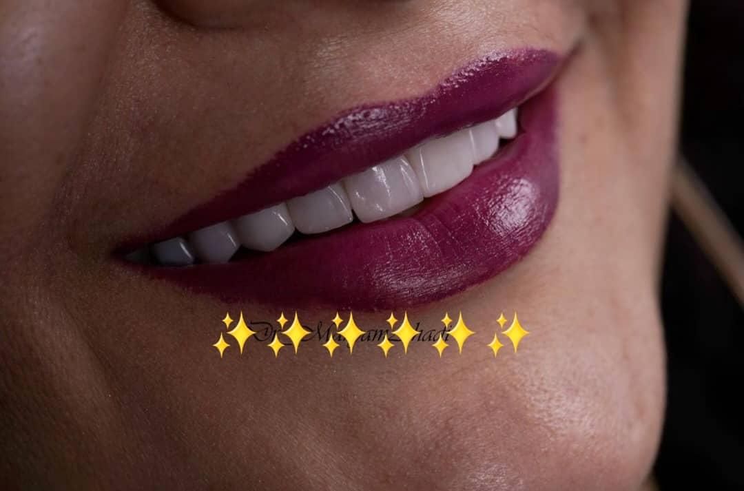 دندانپزشکی زیبایی و درمانی|خدمات آرایشگری و زیبایی|شیراز, ملاصدرا|دیوار