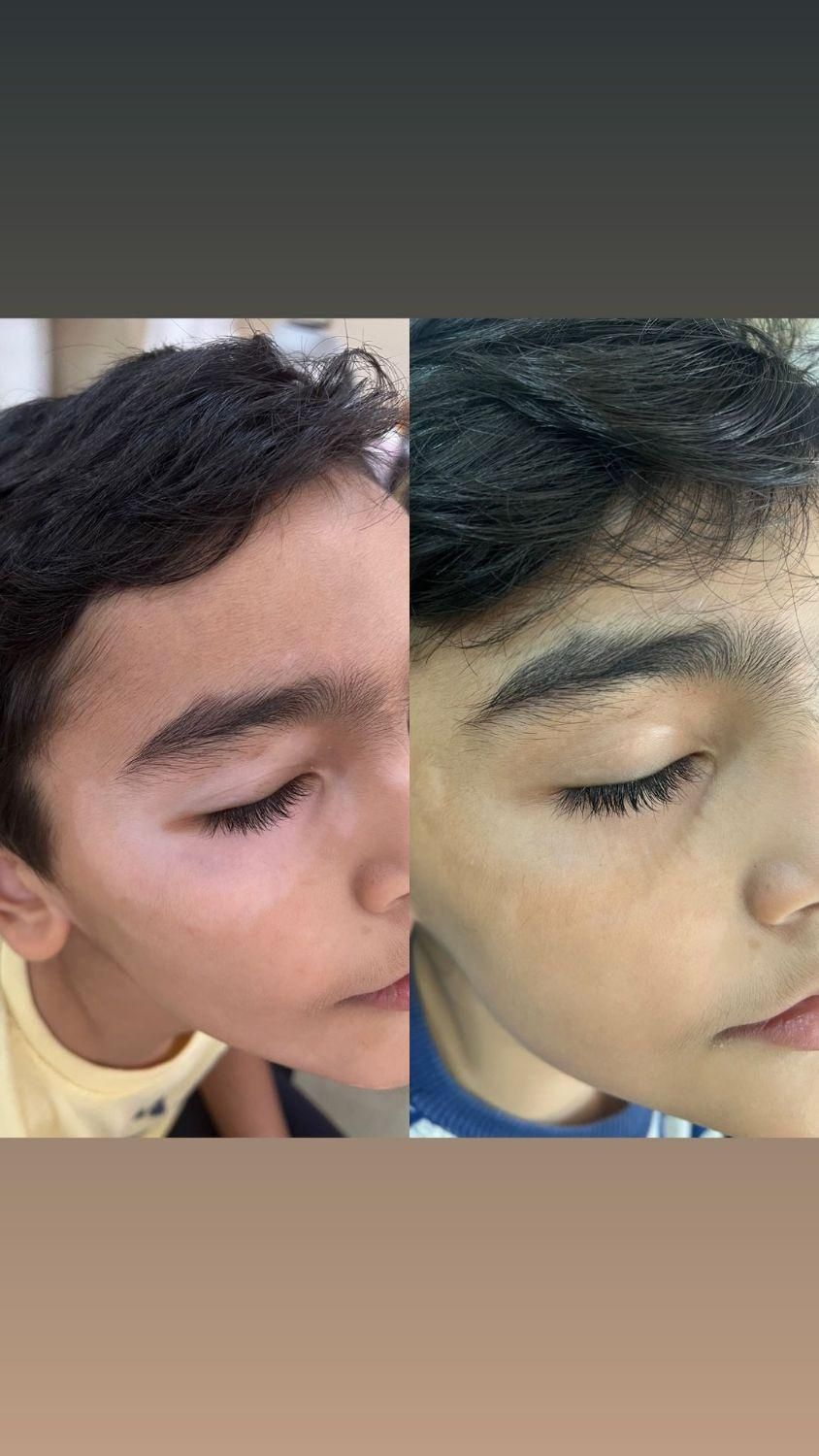 درمان گیاهی بیماری پیسی وپسوریازیس|خدمات آرایشگری و زیبایی|مشهد, حرم مطهر رضوی|دیوار