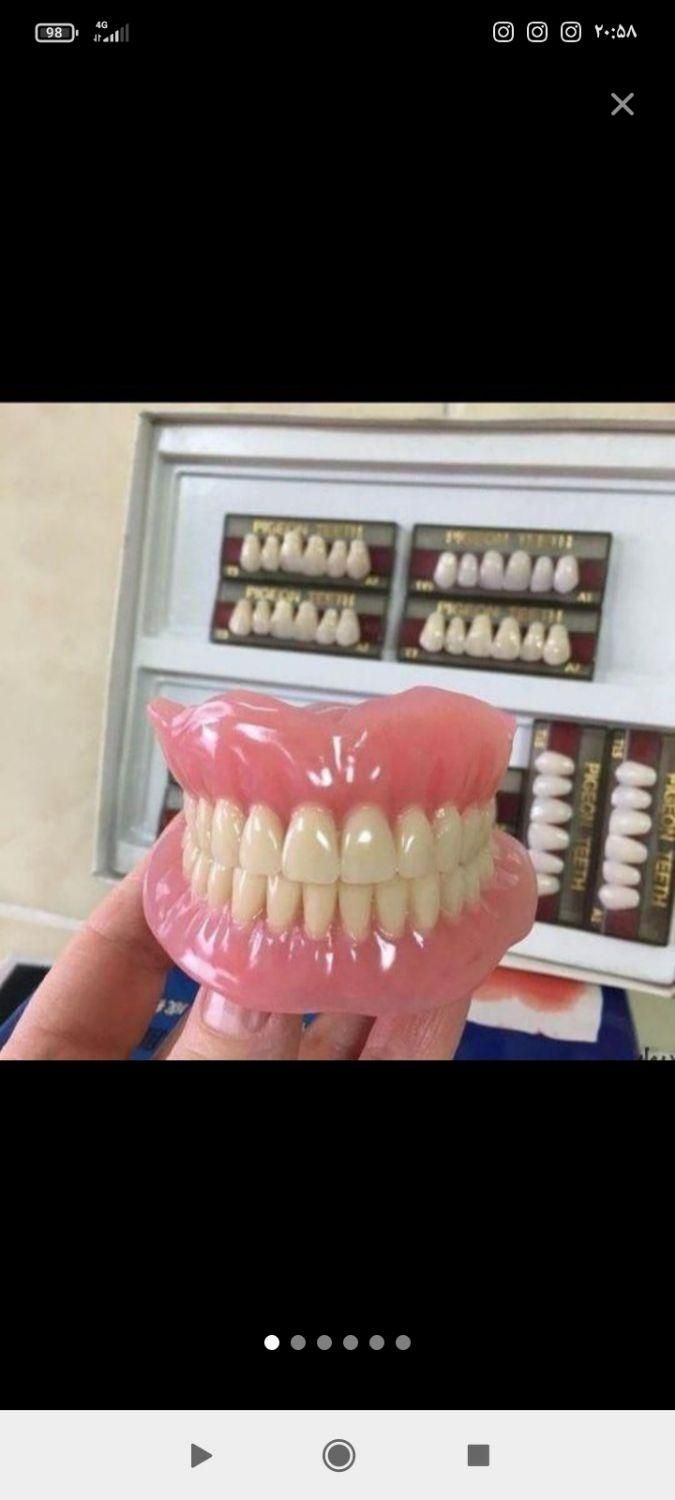 دندانسازی بابک طرح لبخند زیبا دندان|خدمات آرایشگری و زیبایی|اسفراین, |دیوار