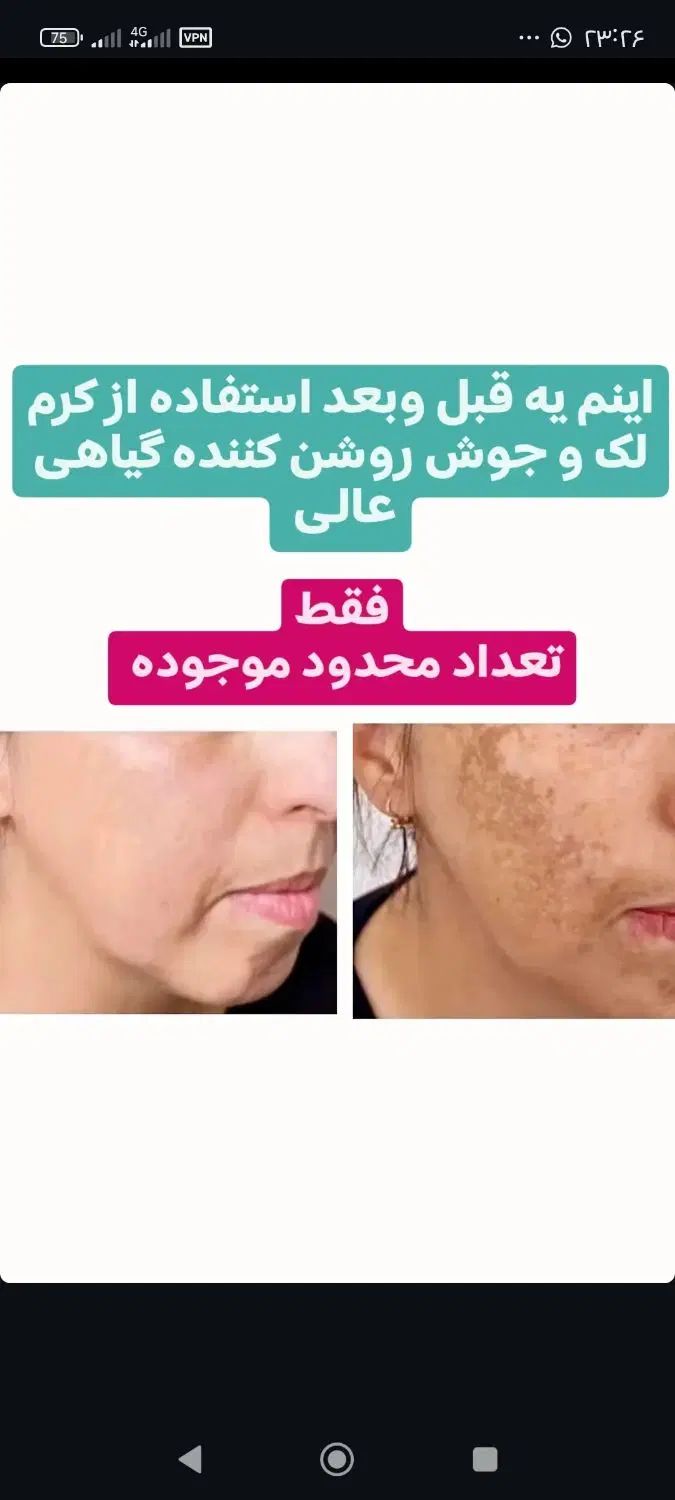 پک کرم شب وروز گیاهی به اضافه صابون مخصوص|آرایشی، بهداشتی، درمانی|عباس‌آباد, |دیوار