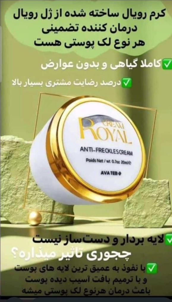 درمان لک پوستی(کک و مک، لک بارداری و جای جوش)|آرایشی، بهداشتی، درمانی|شوشتر, |دیوار