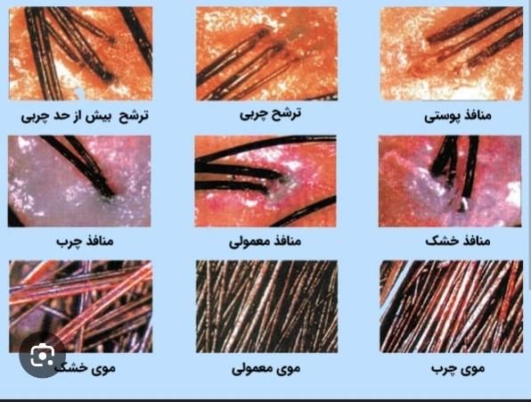 اسکراب اسکالپ در کلینیک تخصصی مو نوراویس|خدمات آرایشگری و زیبایی|مشهد, ملک‌آباد|دیوار