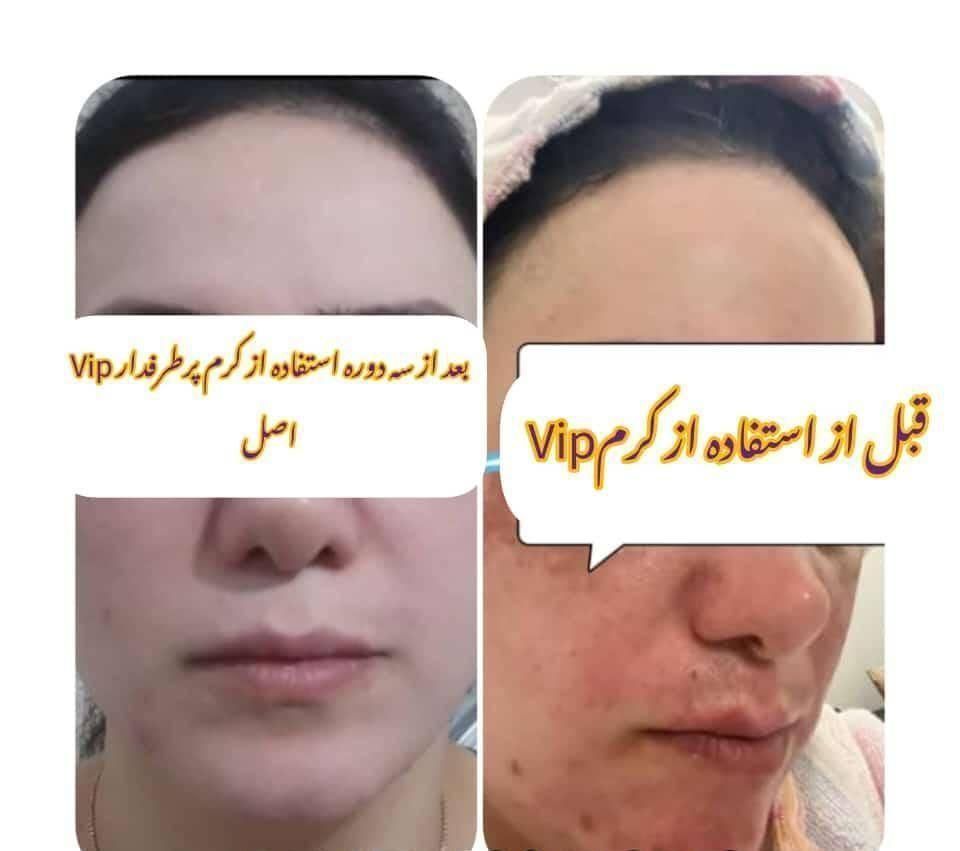 کرم وی آی پی|آرایشی، بهداشتی، درمانی|تهران, باغ فردوس|دیوار