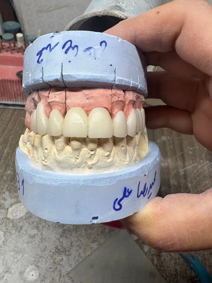 موتور سوار جهت لابراتوار دندانسازی|استخدام حمل و نقل|تهران, دردشت|دیوار