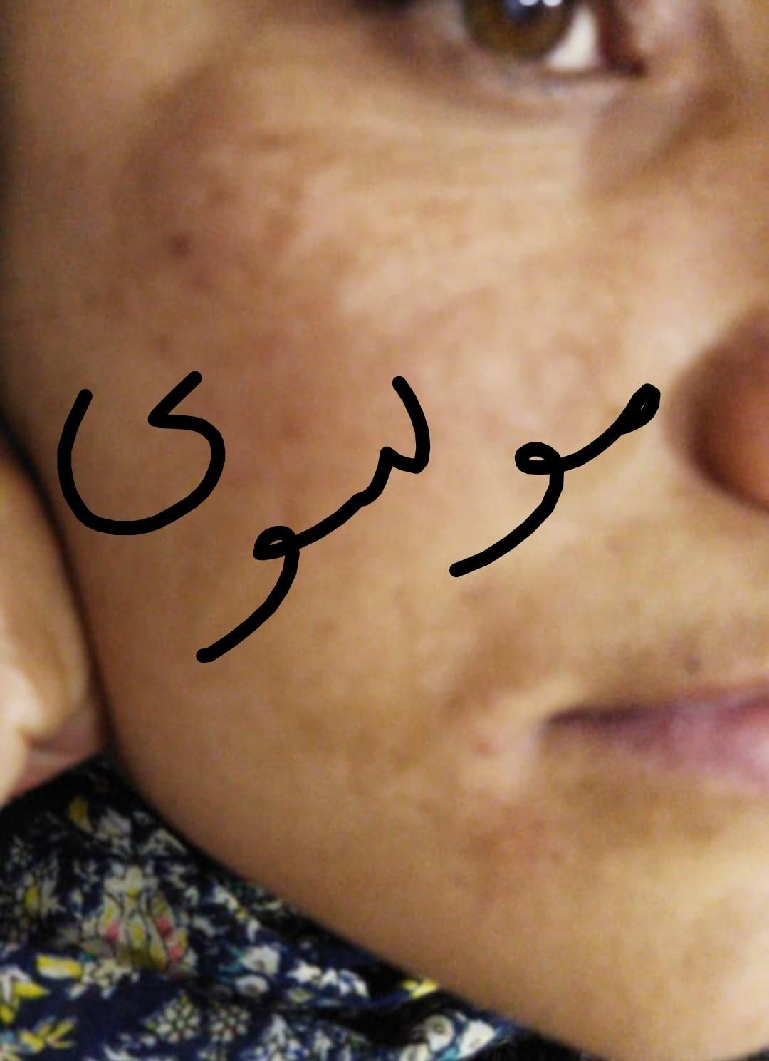 روشن کننده وضدلک درمانی جوابدهی صدرصدی وتضمینی|حراج|لردگان, |دیوار
