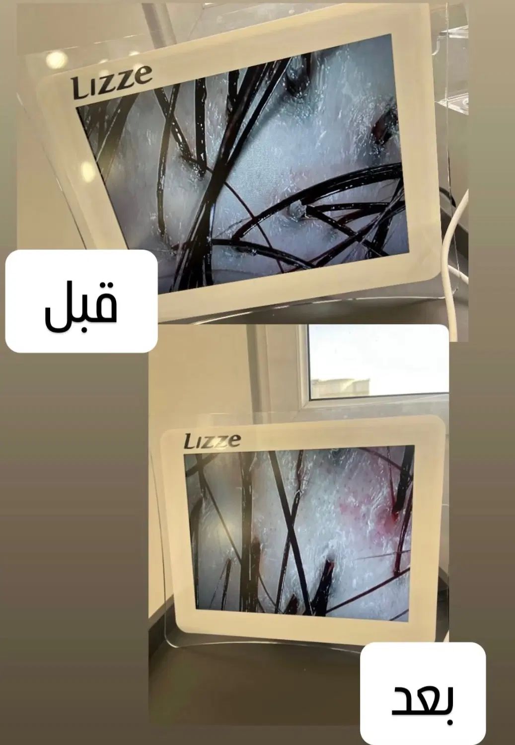 اسکراب اسکالپ(پاکسازی و درمان پوست سر)|خدمات آرایشگری و زیبایی|کرج, مطهری|دیوار