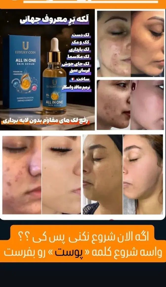 سرم مغذی و ویتامین آ، کرم ضد لک لاکچری کوین|آرایشی، بهداشتی، درمانی|نیشابور, شهرک بسیج|دیوار