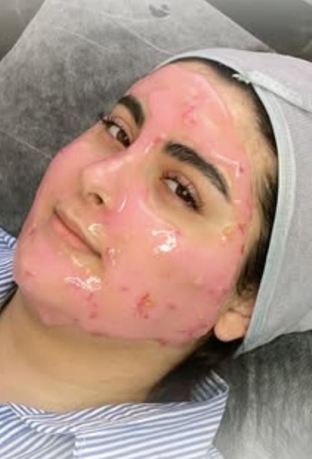 آموزش صفر تا صد پاکسازی پوست در کلینیک با مدرک فنی|خدمات آموزشی|اراک, |دیوار