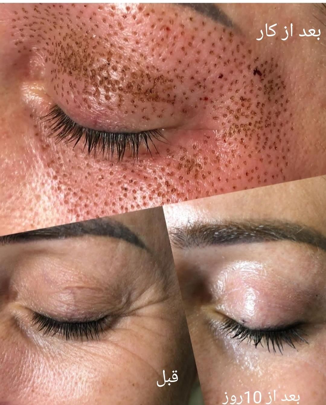 پلاسما جت. لیفت ولمینت ابرو و مژه|خدمات آرایشگری و زیبایی|اصفهان, خواجو|دیوار