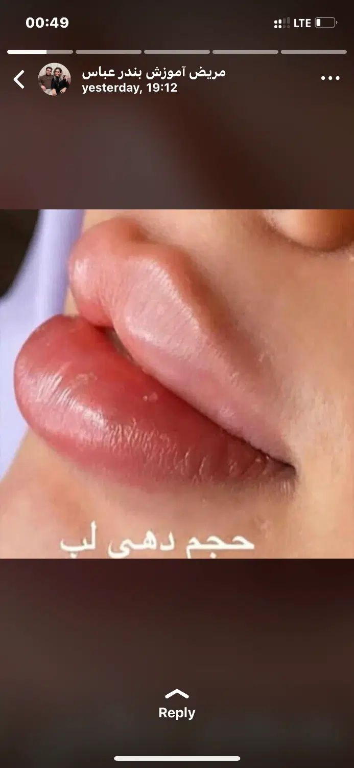 کلینیک زیبایی لریس|خدمات آرایشگری و زیبایی|تهران, تهرانپارس شرقی|دیوار