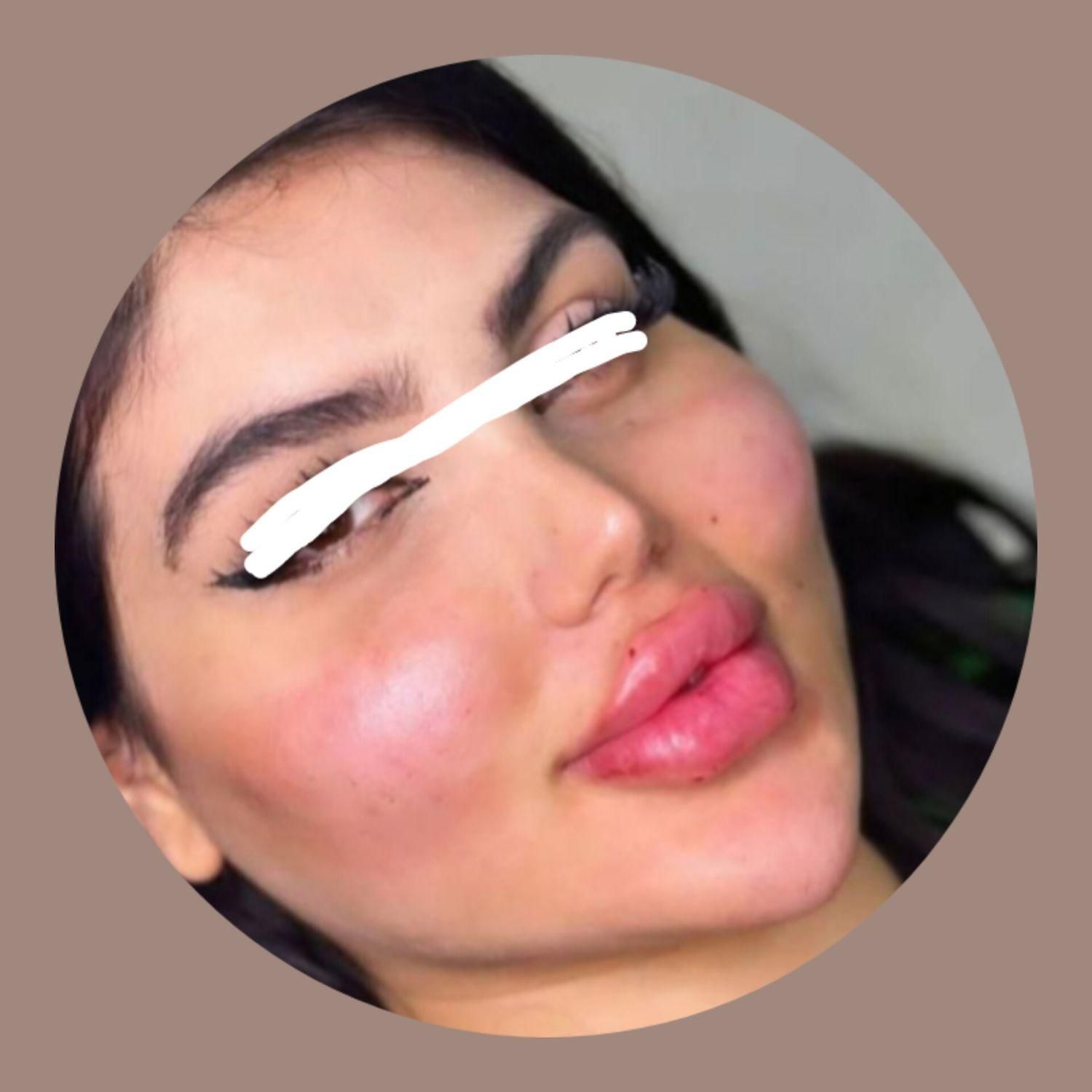 ساکشن غبغب وشکم. کاشت ابرو .|خدمات آرایشگری و زیبایی|پرند, |دیوار