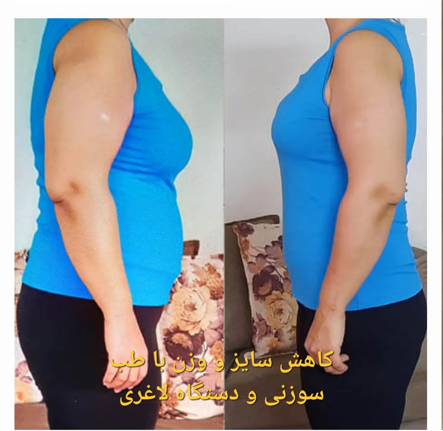 طب سوزنی، بوتاکس، آموزش، مزوتراپی، پلاسماتراپی|خدمات آرایشگری و زیبایی|مشهد, حسابی جنوبی (شهرک غرب)|دیوار