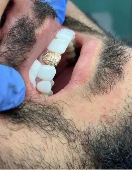 دندانپزشکی ایمپلنت+لمینت+کامپوزیت+ارتودنسی اقساط|خدمات آرایشگری و زیبایی|مشهد, سجاد شهر|دیوار