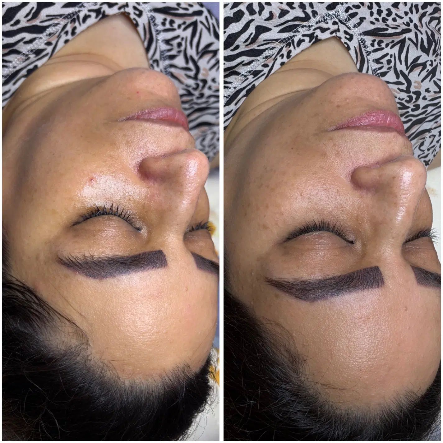 فیشال و پاکسازی تخصصی پوست تخفیف ویژه اولین مراجعه|خدمات آرایشگری و زیبایی|کرج, کوی بعثت|دیوار