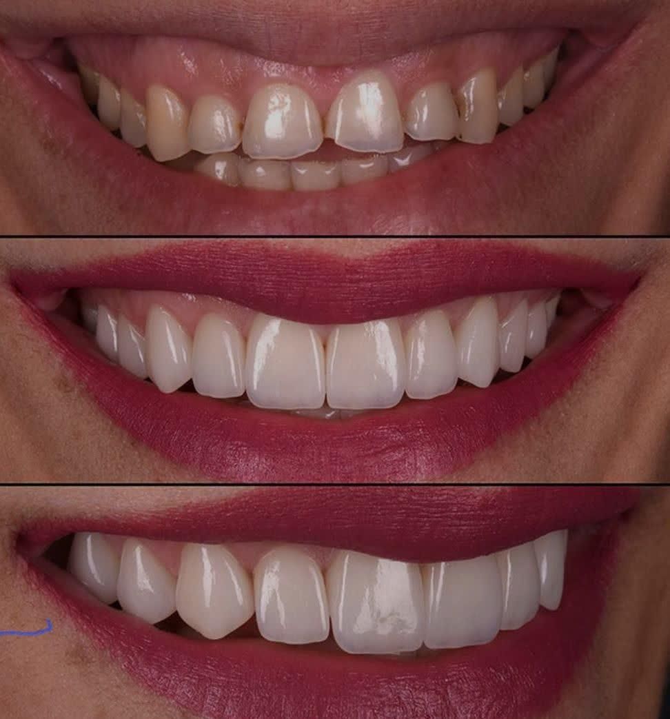 دندانپزشکی،ایمپلنت،ارتودنسی لمینت وکامپوزیت اقساطی|خدمات آرایشگری و زیبایی|نجف‌آباد, شریعتی غربی|دیوار