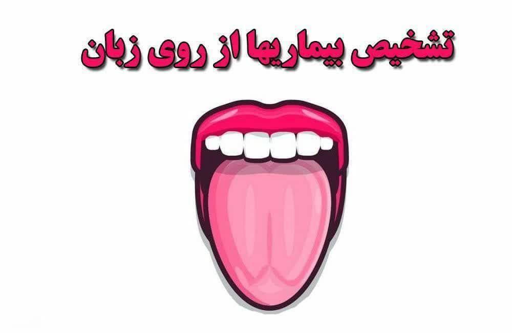 تحلیل زبان شما|خدمات آرایشگری و زیبایی|چالوس, |دیوار