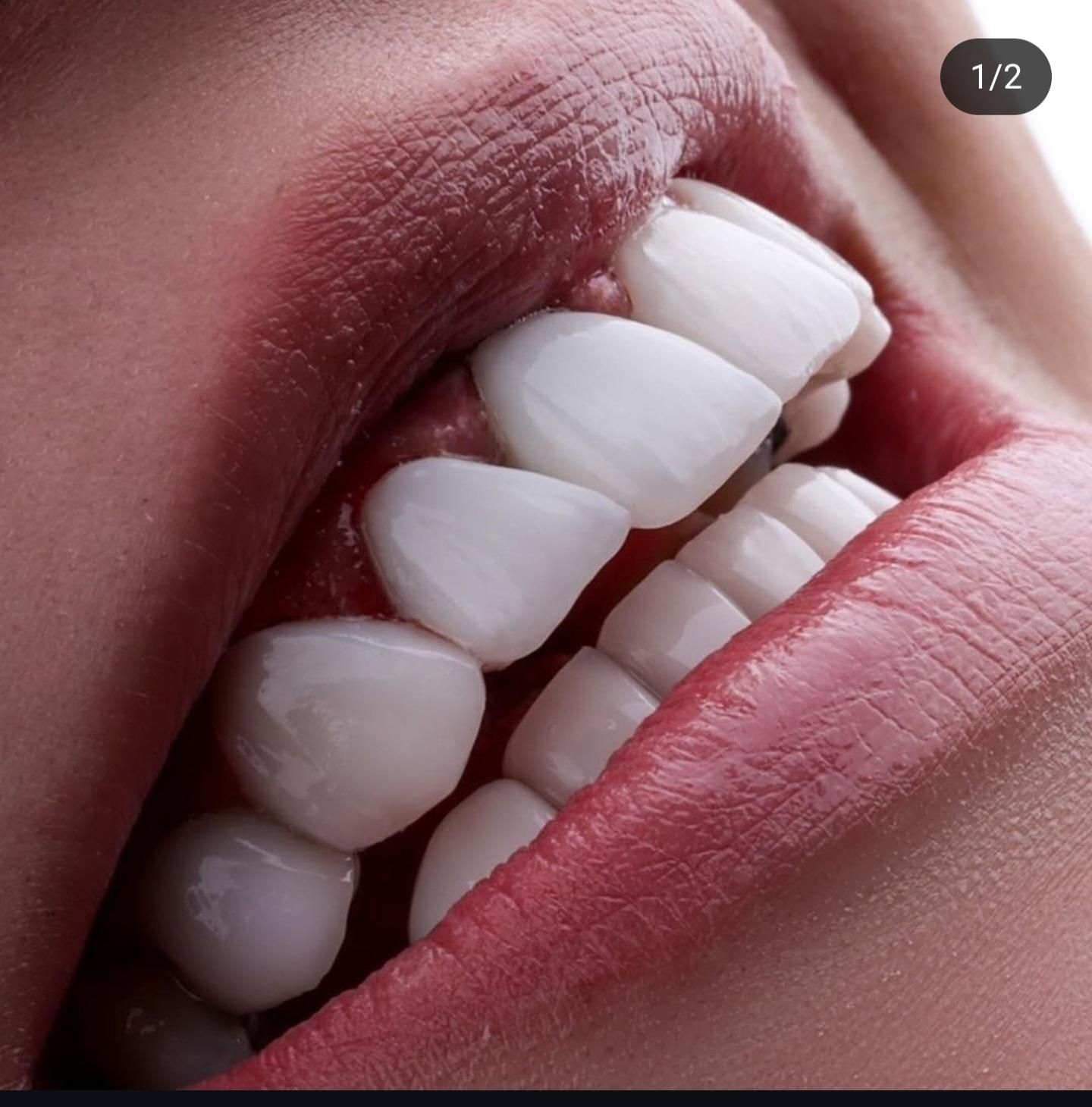 null