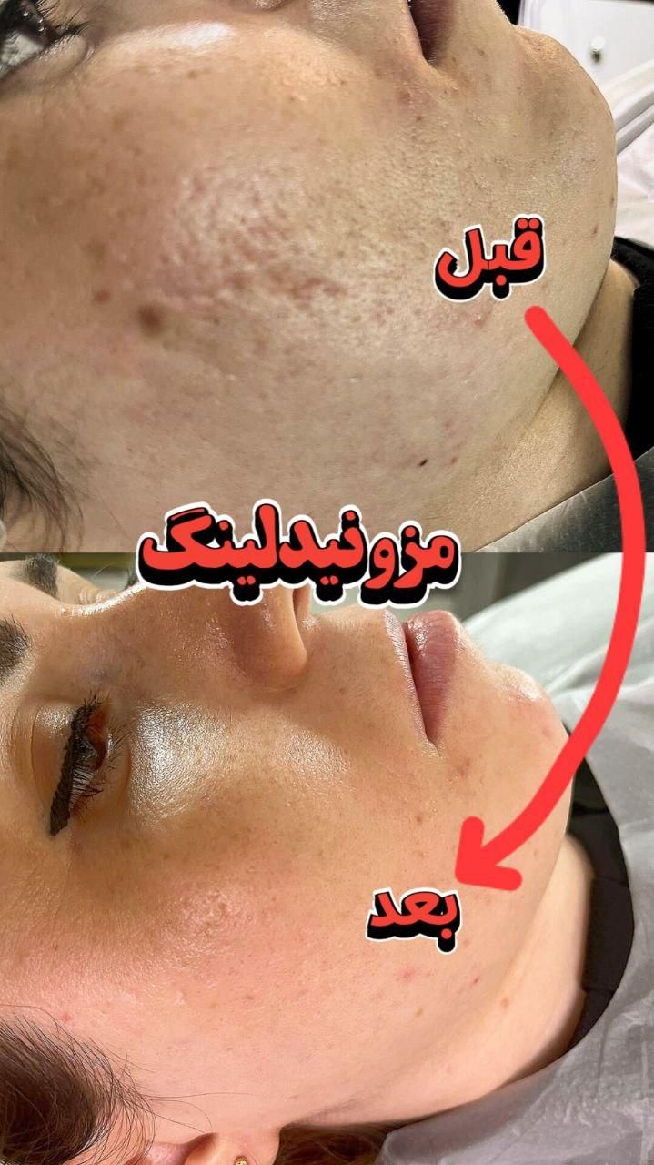 فیشال داخل کیلینیک وسالن زیبایی|خدمات آرایشگری و زیبایی|قم, صدوق|دیوار
