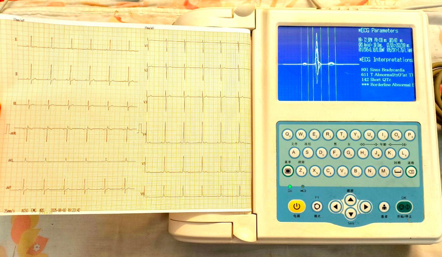 دو دستگاه ECG آلمان و ژاپن|پزشکی|تهران, آذری|دیوار