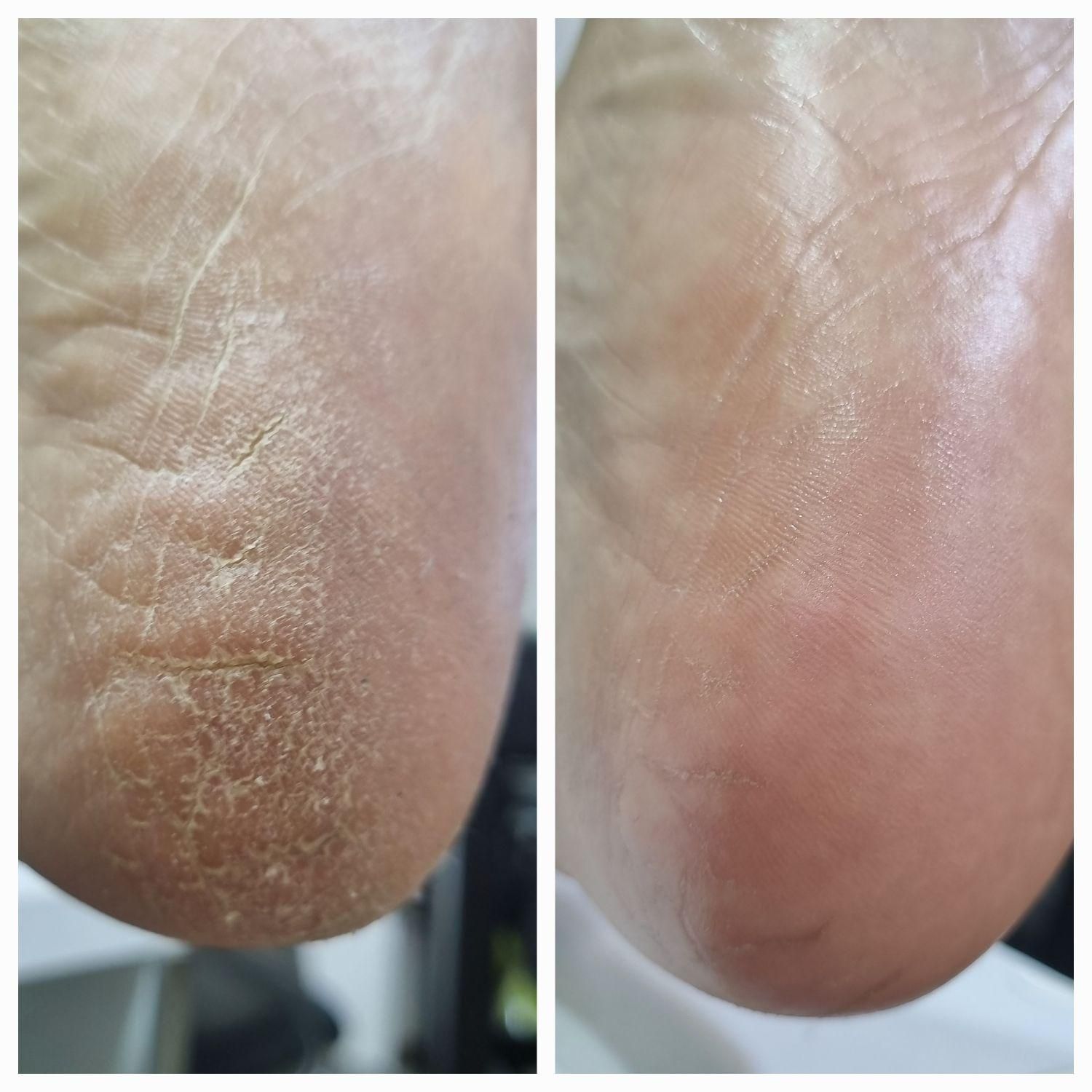 پدیکور و کف سابی|خدمات آرایشگری و زیبایی|رشت, بوسار|دیوار