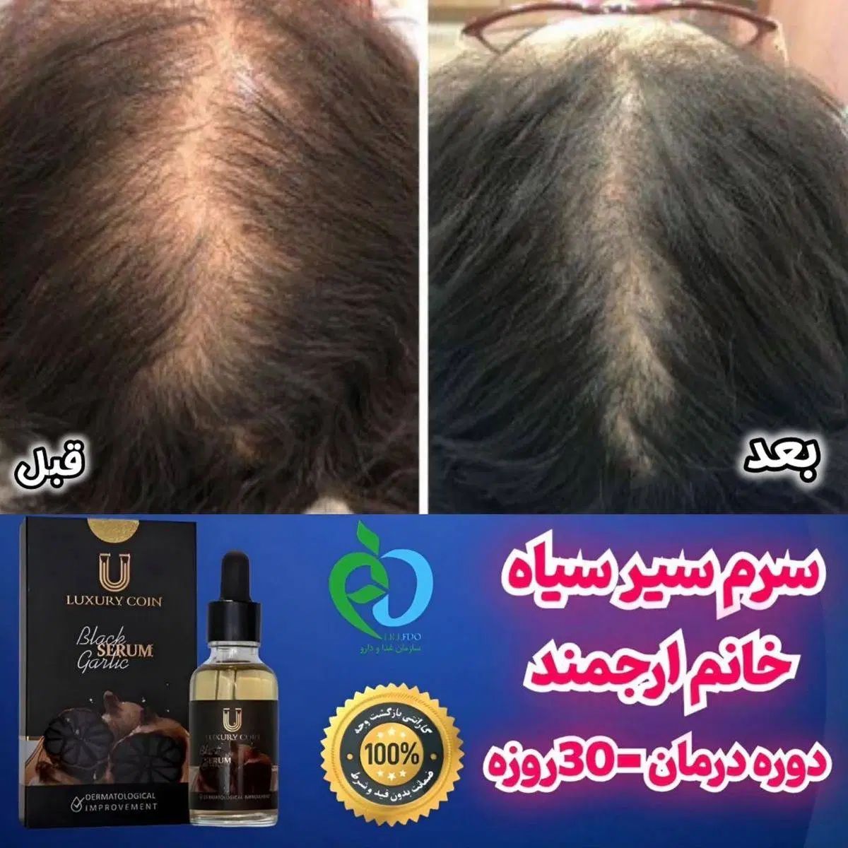 نمایندگی رسمی لاکچری کوین سرم سیرسیاه رویش مجددمو|آرایشی، بهداشتی، درمانی|قم, زنبیل آباد|دیوار