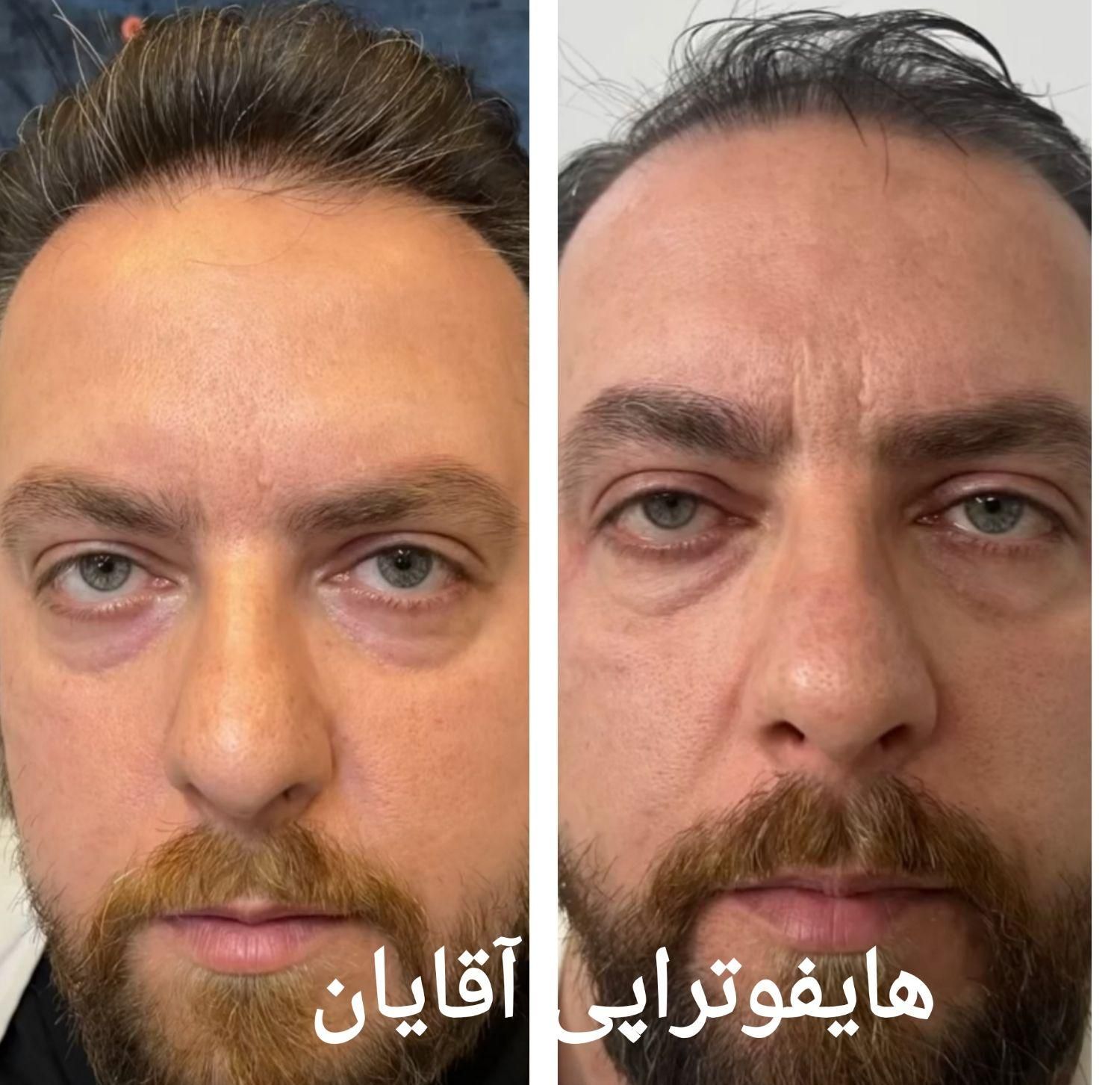 جشنواره تخفیفات کلینیک پوست همراه با هدیه|خدمات آرایشگری و زیبایی|مشهد, کوه سنگی|دیوار