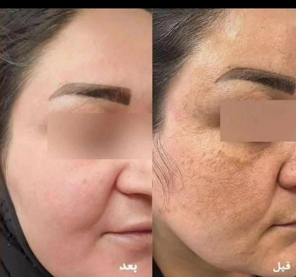 مراقبت پوست و مو|آرایشی، بهداشتی، درمانی|اصفهان, آبشار|دیوار