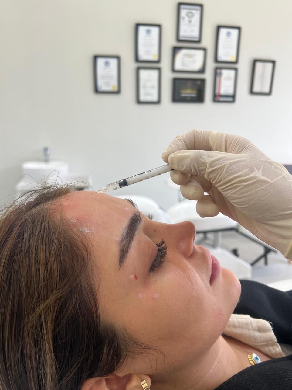 پوستی صاف با لیزر تیتانیوم 2025 بدون درد تضمینی389|خدمات آرایشگری و زیبایی|مشهد, آزادشهر|دیوار