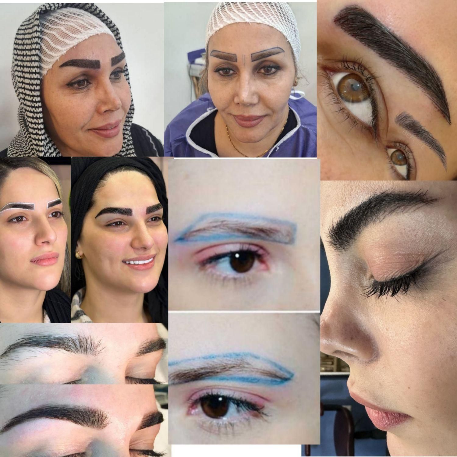 مرکزکاشت مو/ابرو/ریش دنا باتیم کاشت بین‌المللی|خدمات آرایشگری و زیبایی|یاسوج, |دیوار