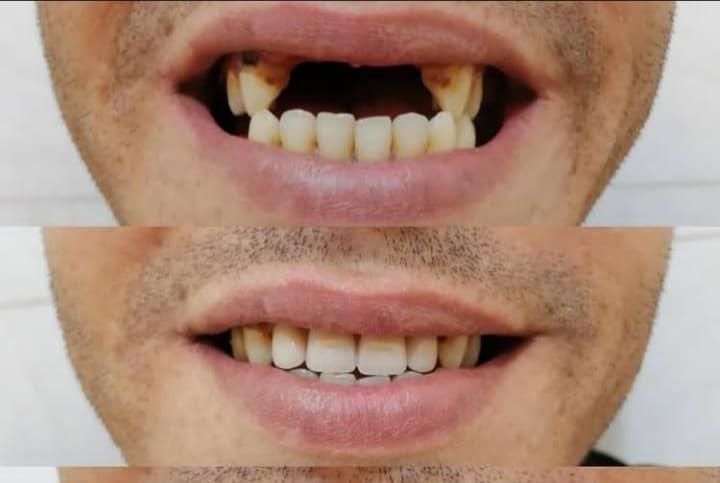 لابراتوار دندانسازی (دندان مصنوعی)|خدمات آرایشگری و زیبایی|اصفهان, جنیران (لادان)|دیوار