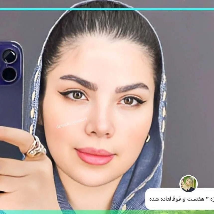 جراحی زیبایی بینی ،گچساران،دکتر نادر موسوی|خدمات آرایشگری و زیبایی|دوگنبدان, |دیوار