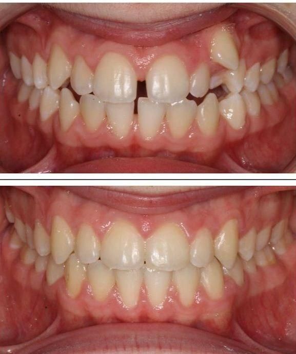 ارتودنسی ارزانتر از تعرفه نظام پزشکی،ایمپلنت فوری|خدمات آرایشگری و زیبایی|تهران, آذربایجان|دیوار